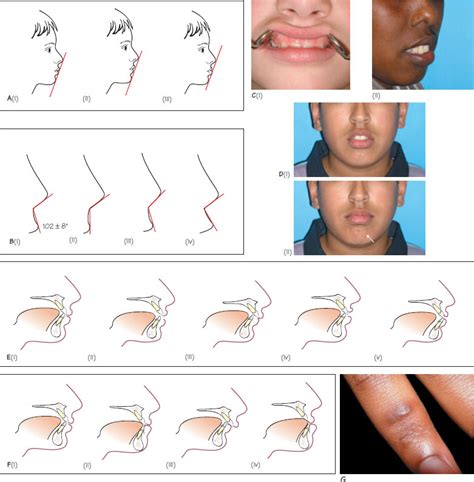 us soft tissue test|soft tissue examination dental.